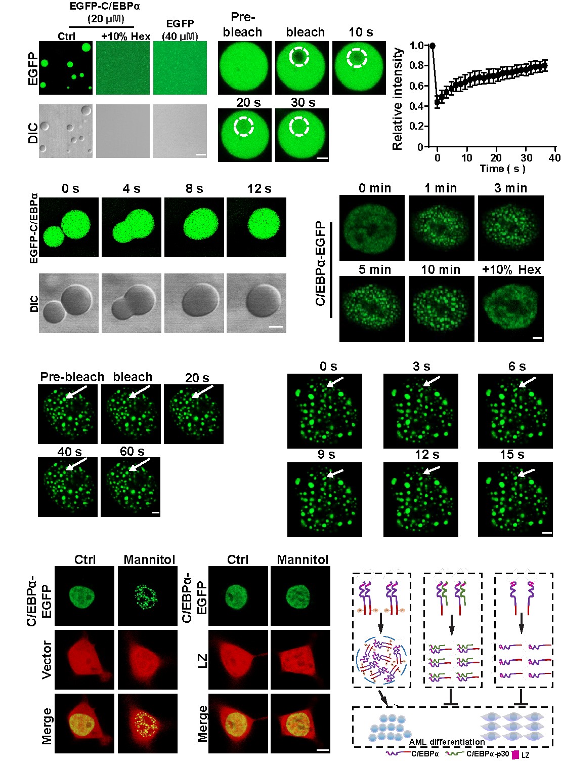 Professor Ji Chunyan’s Team Makes New Progress in the Field of Acute Myeloid Leukemia